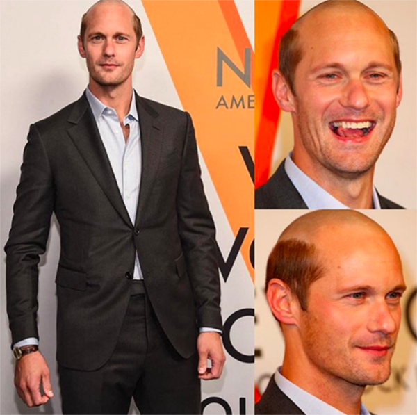 alexander-skarsgard